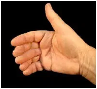 Sixth Finger (Vernet) - image 2