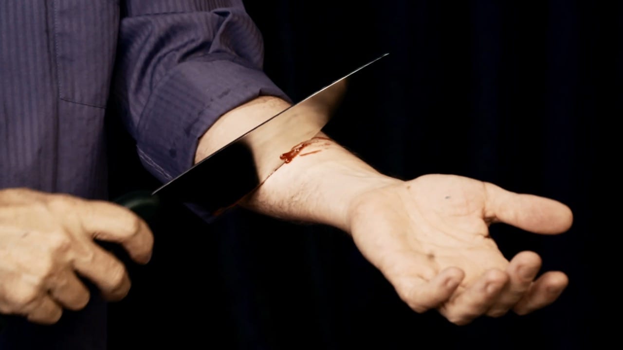 The Amazing Johnathan’s Knife Through Arm - thumbnail 3