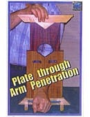 Plates Through Arm Illusion Trick