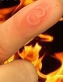 Sharp Burn Trick